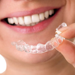 woman holding Invisalign clear aligner