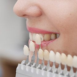 Dentist holding row of veneers next to smiling patient