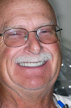 Albuquerque dental patient Ken smiling