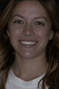 Dental patient Meagan smiling