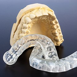 Two clear occusal splints next to model of the teeth