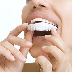 person using a take home teeth whitening kit
