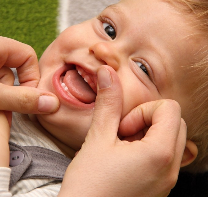Pulling up childs lip to show baby teeth