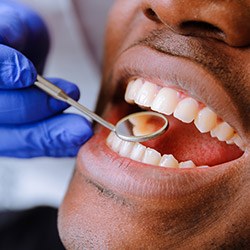 man having teeth checked