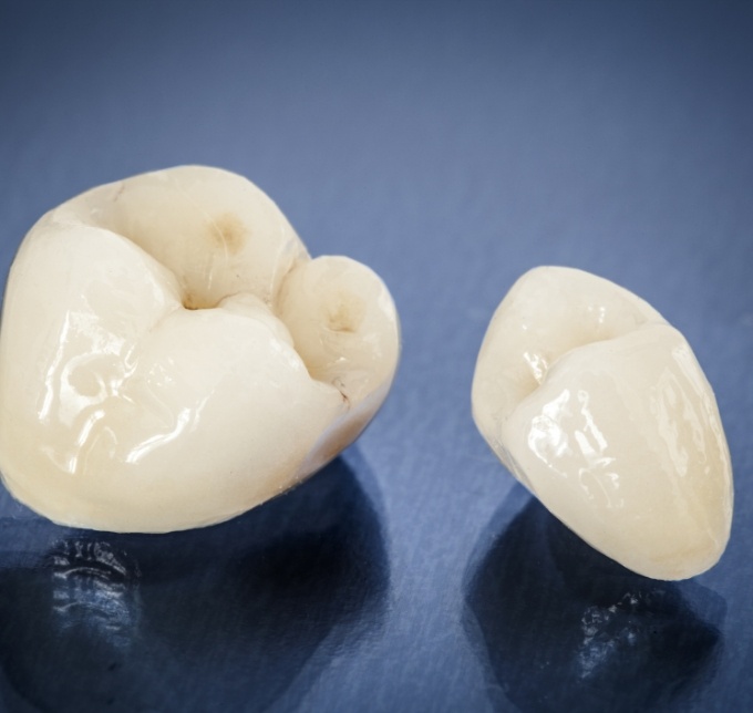 Two dental crowns sitting next to each other
