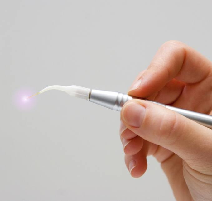 Hand holding a dental laser
