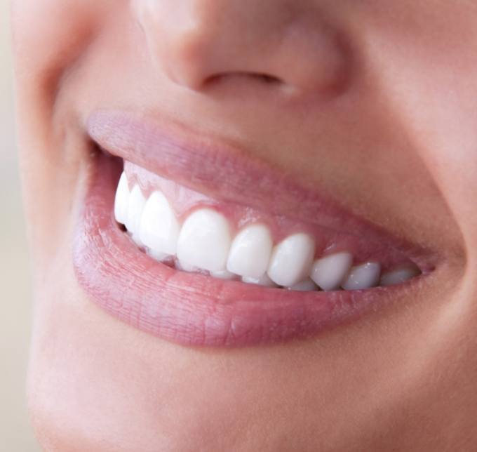 Close up of a patients smile