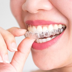 A woman inserting a clear aligner into her mouth