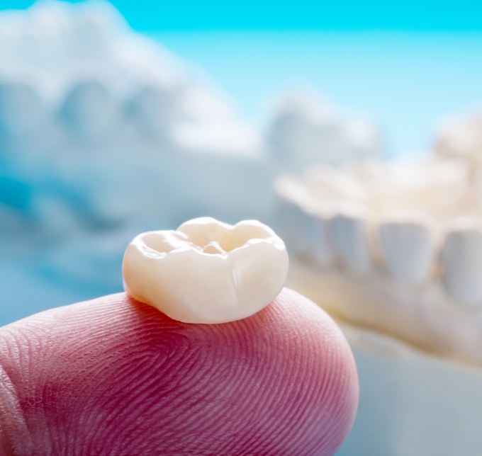 Dental crown resting on a finger