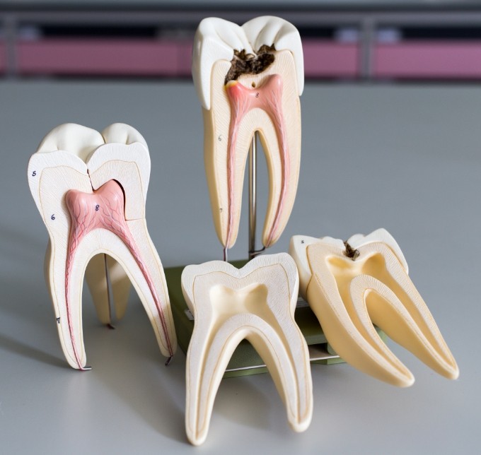 Several models of teeth