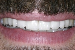 Smile with brighter teeth