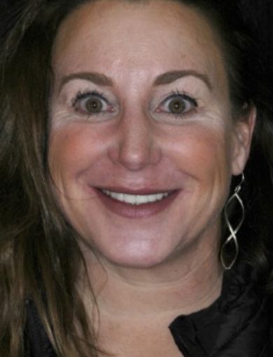 Dental patient Rachel smiling