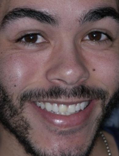 Dental patient Shaun smiling