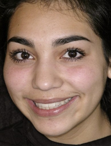 Dental patient Tani smiling