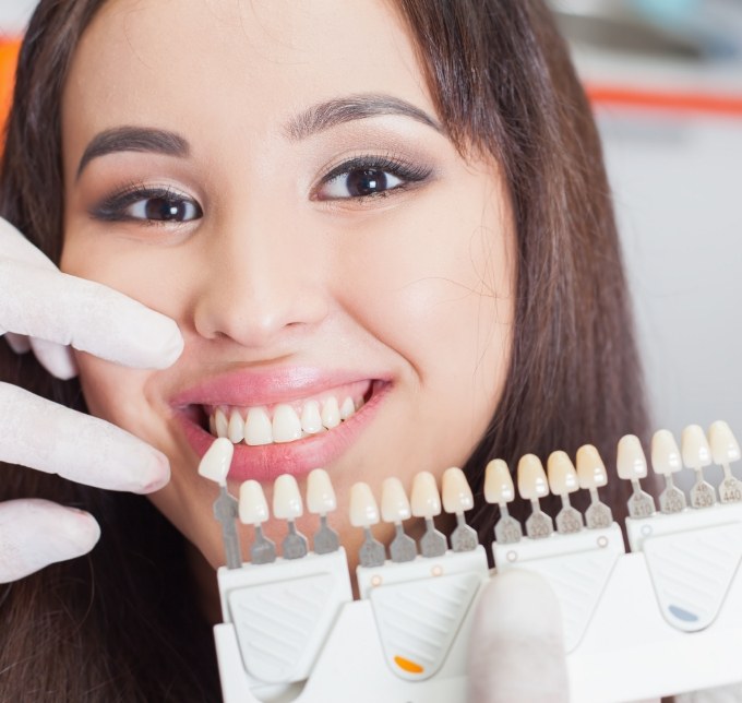 Shade matching teeth for veneers in Albuquerque